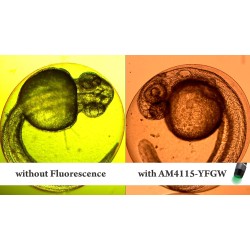 Microscop Fluorescenta PORTOCALIE - ROSIE cu lumina verde (525 nm) si filtru 570 nm - AM4115T-YFGW Microscop Fluorescenta PORTOCALIE - ROSIE cu lumina verde (525 nm) si filtru 570 nm - AM4115T-YFGW